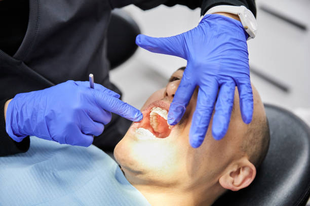 Best Chipped Tooth Repair Near Me  in Mckees Rocks, PA